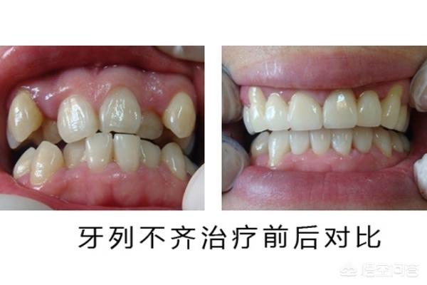 大理最新24小时牙医在线咨询方法分析(最方便真实的大理有没有24小时牙医方法)